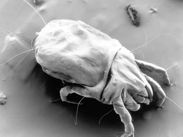 High-contrast scanning electron microscope image of a dust mite with visible legs and sensory hairs